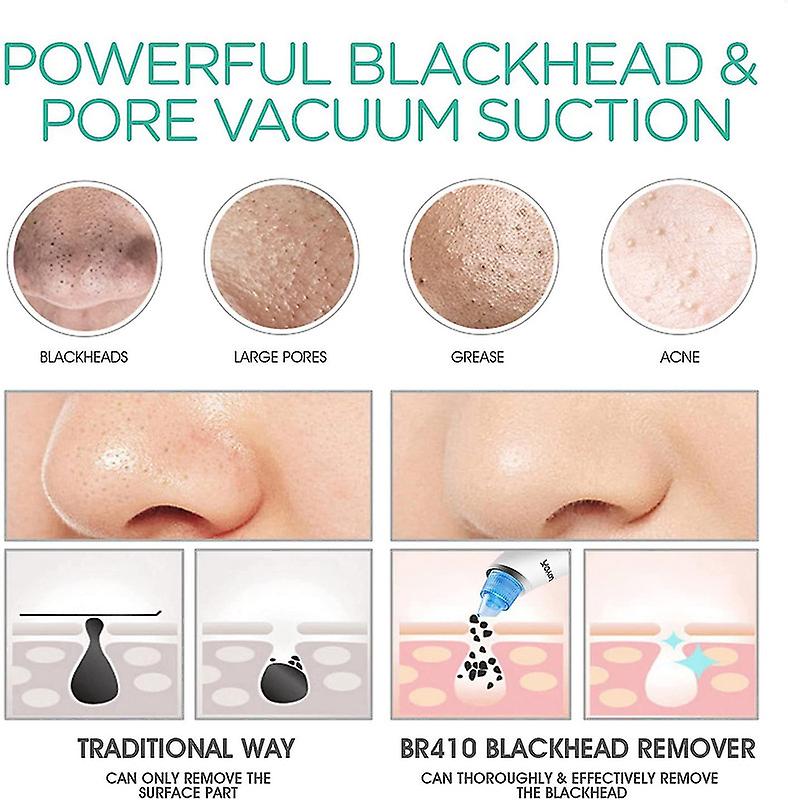 Electric Blackhead Acne Oil Remover Vacuum Suction Face Pore Cleaner Facial Beauty Equipment,Blackhead Removal Machine