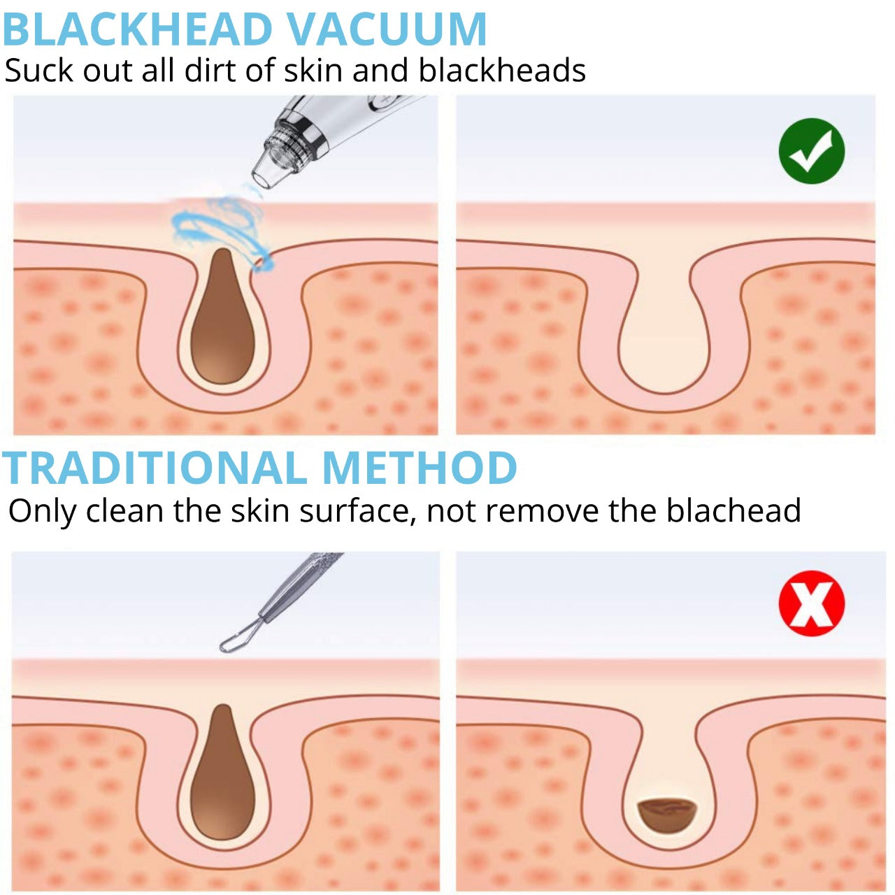 Electric Blackhead Acne Oil Remover Vacuum Suction Face Pore Cleaner Facial Beauty Equipment,Blackhead Removal Machine